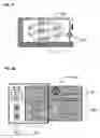 Fig. 06 - ABDOMINAL CIRCULATORY PUMP DEVICE