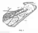 Fig. 02 - Catheter drug pump