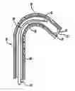 Fig. 01 - Catheter with flexible tip and shape retention