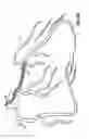 Fig. 14 - Catheter with flexible tip and shape retention
