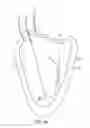 Fig. 04 - Percutaneous guidewire