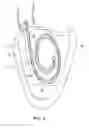 Fig. 06 - Percutaneous guidewire