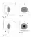 Fig. 06 - Ophthalmologic laser system