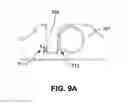 Fig. 09 - Method and apparatus for endoscopic ligament release