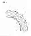 Fig. 02 - Stent