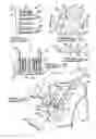Fig. 02 - Apparatus and method for tibial fixation of soft tissue