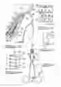 Fig. 07 - Apparatus and method for tibial fixation of soft tissue