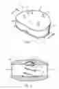 Fig. 02 - Artificial intervertebral disc implant