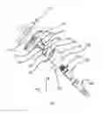 Fig. 03 - Prosthetic knee void filers with splined fixation