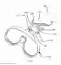 Fig. 05 - Prosthetic knee void filers with splined fixation