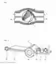 Fig. 02 - Finger joint prosthesis