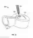 Fig. 09 - IMPLANT COMPONENTS AND METHODS