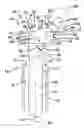 Fig. 01 - ORTHOPAEDIC IMPLANT KIT, ORTHOPAEDIC SURGERY KIT AND ASSOCIATED METHOD