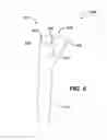 Fig. 07 - ORTHOPAEDIC IMPLANT KIT, ORTHOPAEDIC SURGERY KIT AND ASSOCIATED METHOD