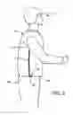 Fig. 02 - Rapid opening feature on tactical jacket