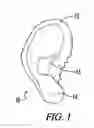 Fig. 02 - Ear Protector