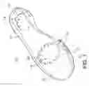 Fig. 02 - ORTHOTIC SHOE AND INSOLE ASSEMBLIES