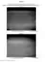 Fig. 07 - Stainless steel carburization process
