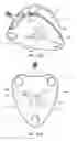 Fig. 44 - Systems and methods for radiographically identifying an access port