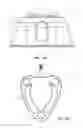 Fig. 46 - Systems and methods for radiographically identifying an access port
