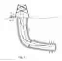 Fig. 02 - Method of detecting fluid in-flows downhole