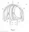 Fig. 02 - Headphones