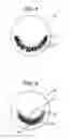 Fig. 02 - Tinted contact lenses with crescent patterns