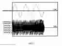 Fig. 06 - Method and system for measuring noise of a magnetic head
