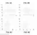 Fig. 06 - Multi-bit STRAM memory cells