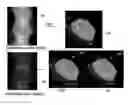 Fig. 01 - System and method for reconstruction of X-ray images