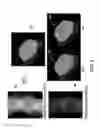 Fig. 05 - System and method for reconstruction of X-ray images