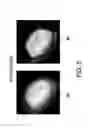Fig. 06 - System and method for reconstruction of X-ray images