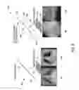 Fig. 07 - System and method for reconstruction of X-ray images
