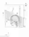Fig. 07 - X-RAY CT APPARATUS
