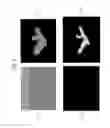 Fig. 06 - Device, method, and computer-readable storage medium for segmentation of an image