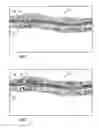 Fig. 02 - Method and system for analyzing optical coherence tomography (OCT) results using color reflectivity discretization analysis