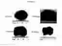 Fig. 07 - Cytotoxicity mediation of cells evidencing surface expression of CD44