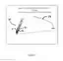 Fig. 02 - Intravascular imaging device and uses thereof
