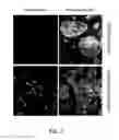 Fig. 03 - Multi plasmid system for the production of influenza virus
