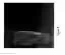 Fig. 14 - STRUCTURED SILVER-MESOPOROUS SILICA NANOPARTICLES HAVING ANTIMICROBIAL ACTIVITY