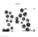 Fig. 04 - Methods and systems for inducing immunologic tolerance to non-self antigens