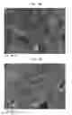 Fig. 08 - Belt-creped, variable local basis weight multi-ply sheet with cellulose microfiber prepared with perforated polymeric belt