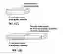 Fig. 03 - Graphite or carbon particulates for the lithium ion battery anode