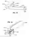 Fig. 12 - Devices and methods for collecting and analyzing fluid samples from the oral cavity