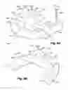 Fig. 09 - Dental prosthetic and restoration removal system and method