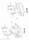 Fig. 10 - Dental prosthetic and restoration removal system and method
