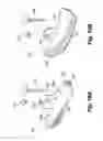 Fig. 12 - Dental prosthetic and restoration removal system and method