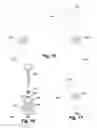 Fig. 14 - Dental prosthetic and restoration removal system and method