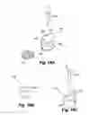 Fig. 15 - Dental prosthetic and restoration removal system and method