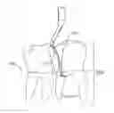 Fig. 01 - PERIODONTAL SCALER
